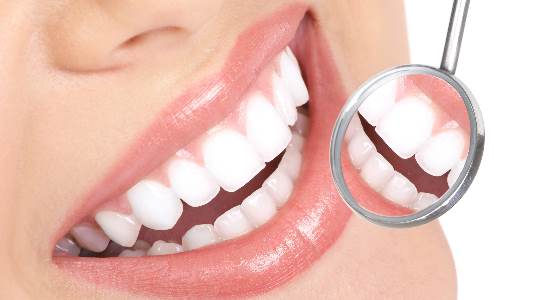 Composites Dental